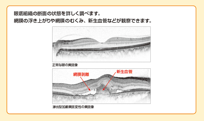 眼底組織の断面の状況を詳しく調べます